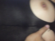 炮友刚做完手术就迫不及待被大鸡巴插入